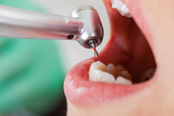 Fast & Reliable Emergency Dental Services in AL